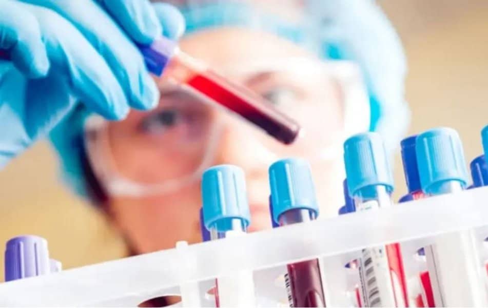 o krvna grupa smanjuje rizik od raka debelog crijeva i gusterace