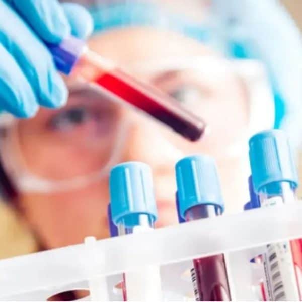 Koja krvna grupa ima najmanji rizik od raka