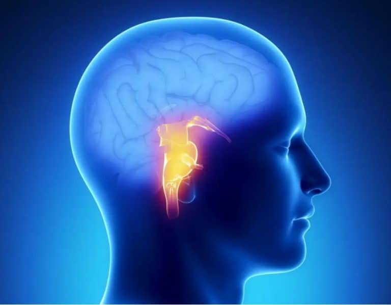 rani simptomi mozdanog udara obratite paznju