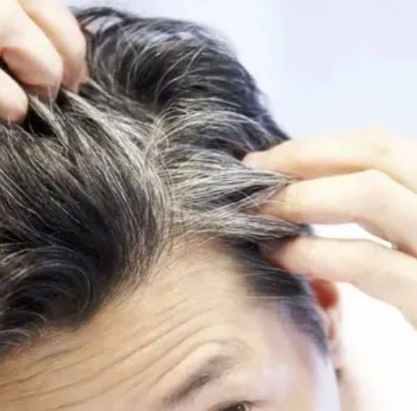 Sijeda kosa govori više nego što mislite: Šta trebate znati!