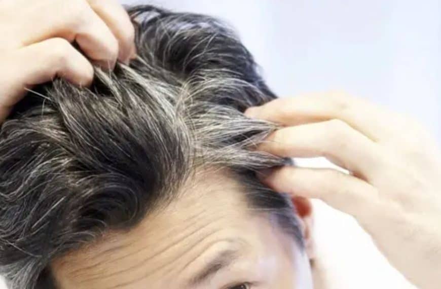 Sijeda kosa govori više nego što mislite: Šta trebate znati!